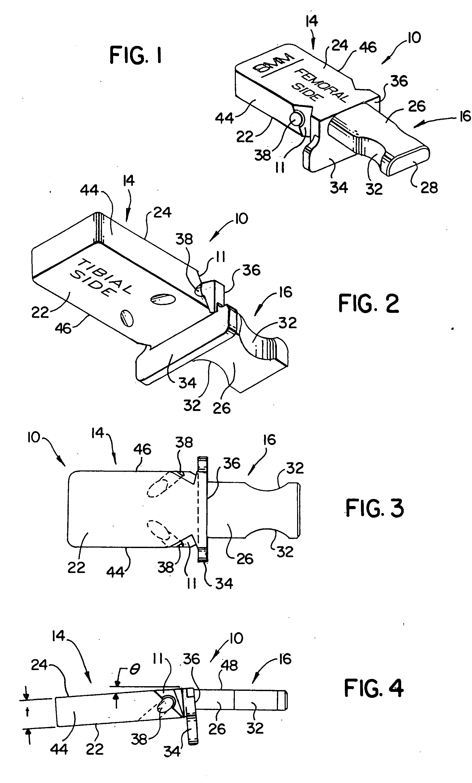 Tibial spacer blocks and femoral cutting guide