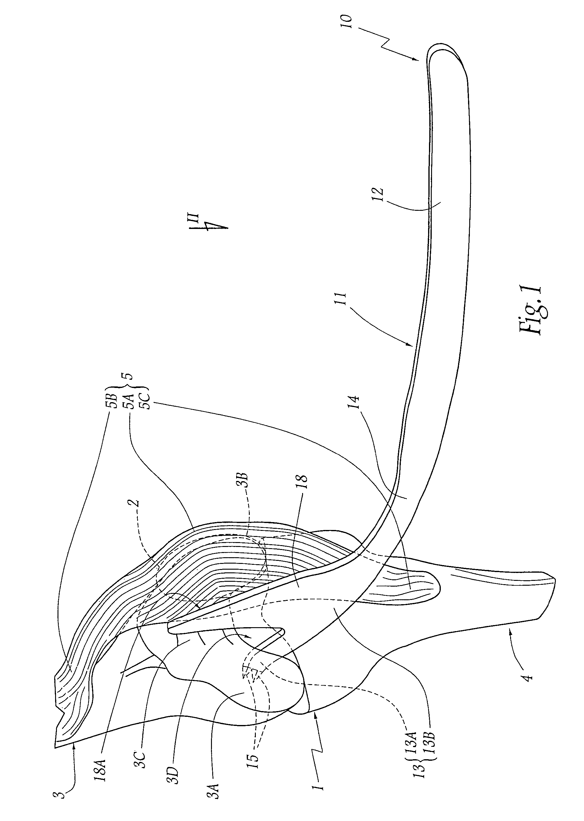 Patellar retractor and method of surgical procedure on knee