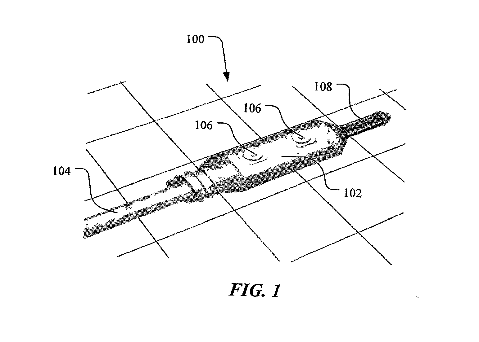 Method and apparatus for shunting induced currents in an electrical lead