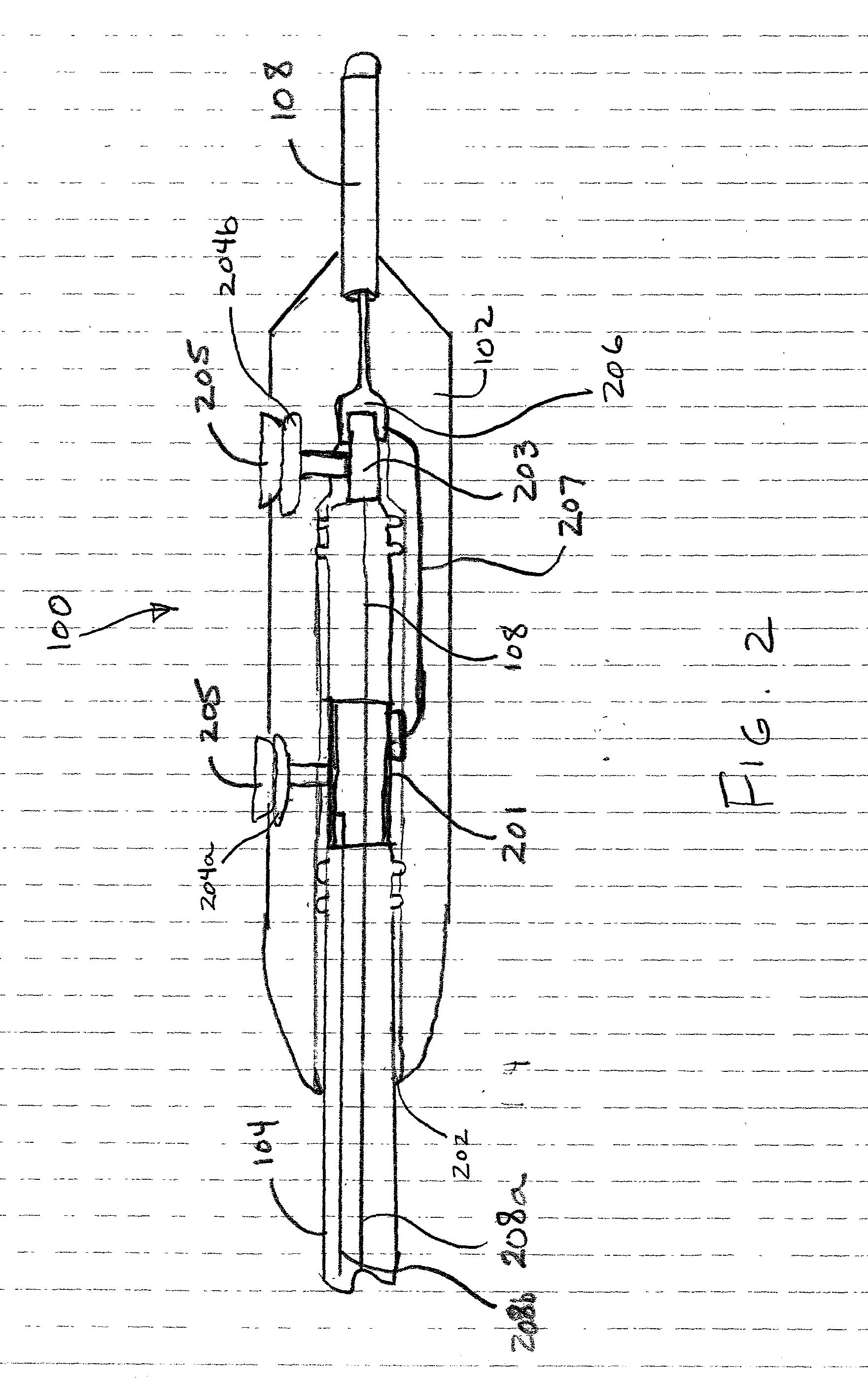 Method and apparatus for shunting induced currents in an electrical lead