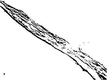 Anti-adhesion biological membrane and preparation method thereof