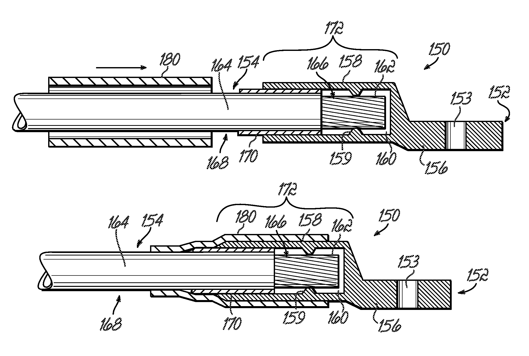 Integral bonding attachment