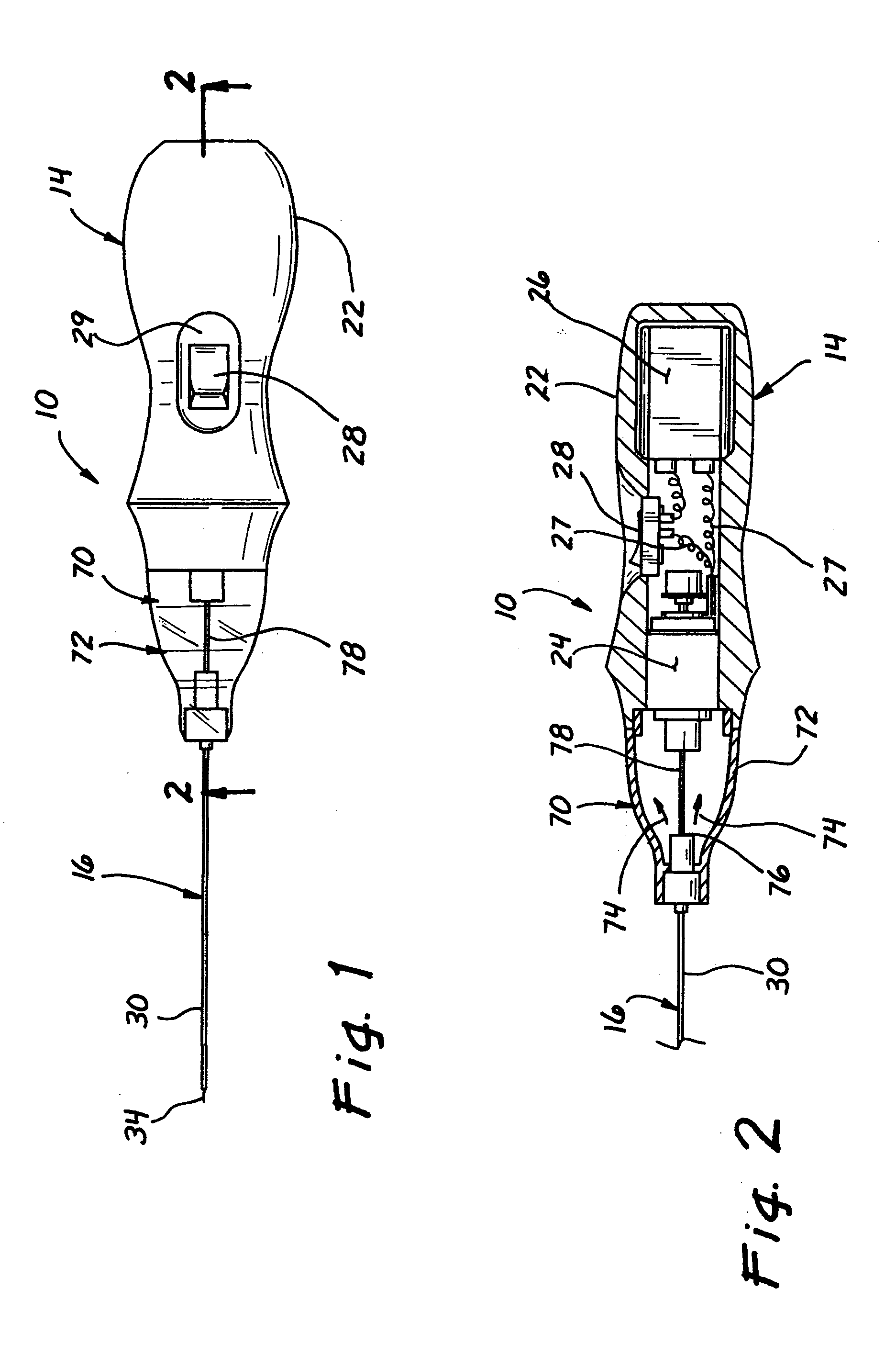 Micro-invasive tissue removal device