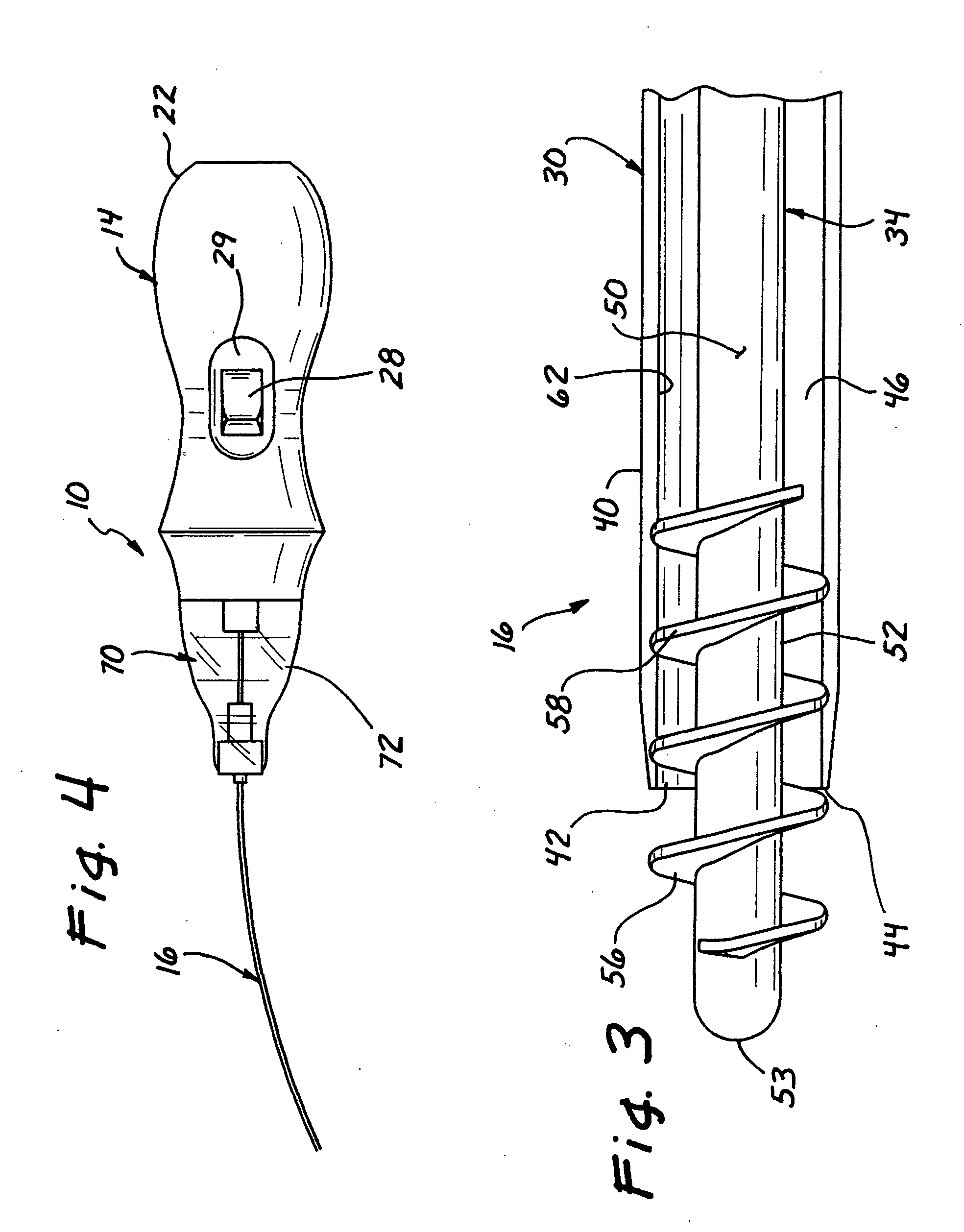 Micro-invasive tissue removal device