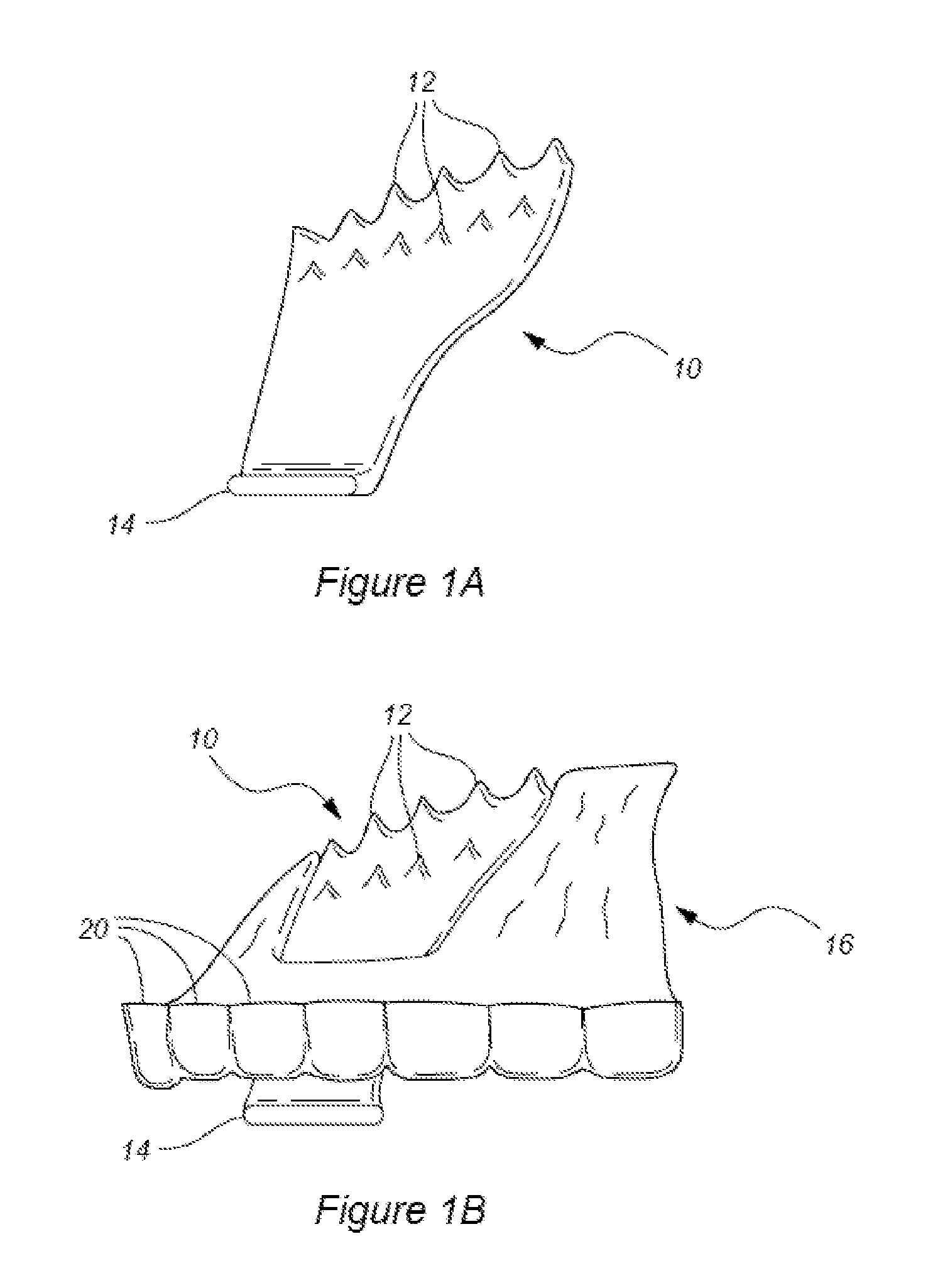 Device and Methods for Treatment of Bruxism and TMJ Disorder