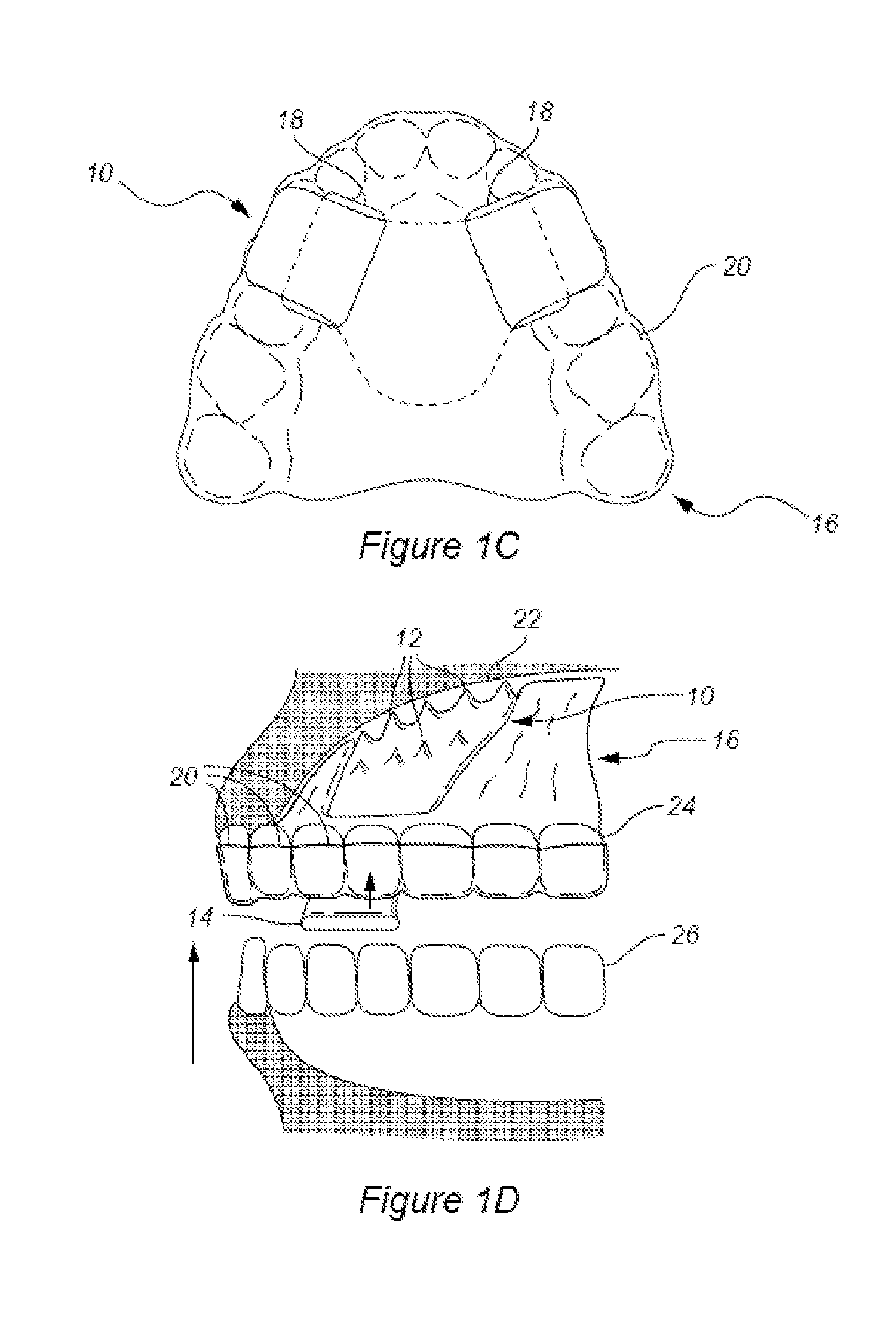 Device and Methods for Treatment of Bruxism and TMJ Disorder