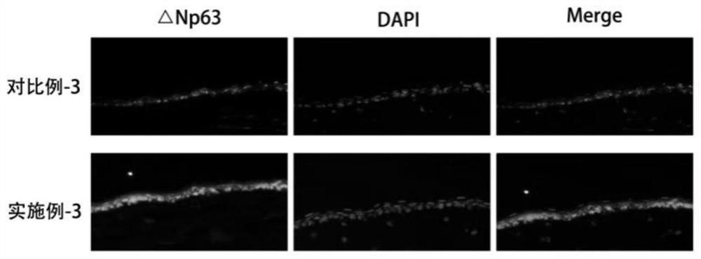 An eye drop suitable for corneal limbal stem cell deficiency and its preparation