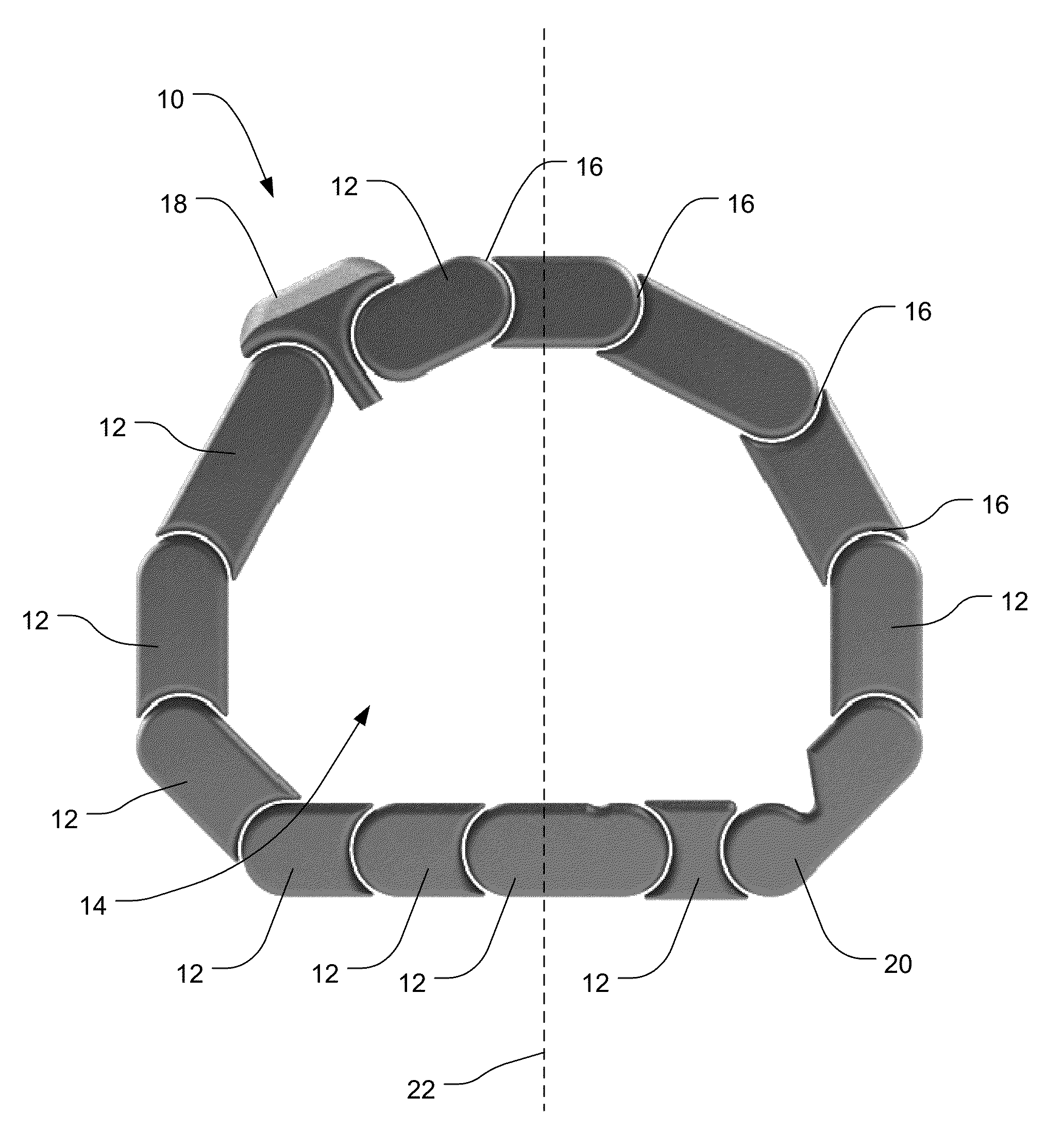 IBD Expandable Ti