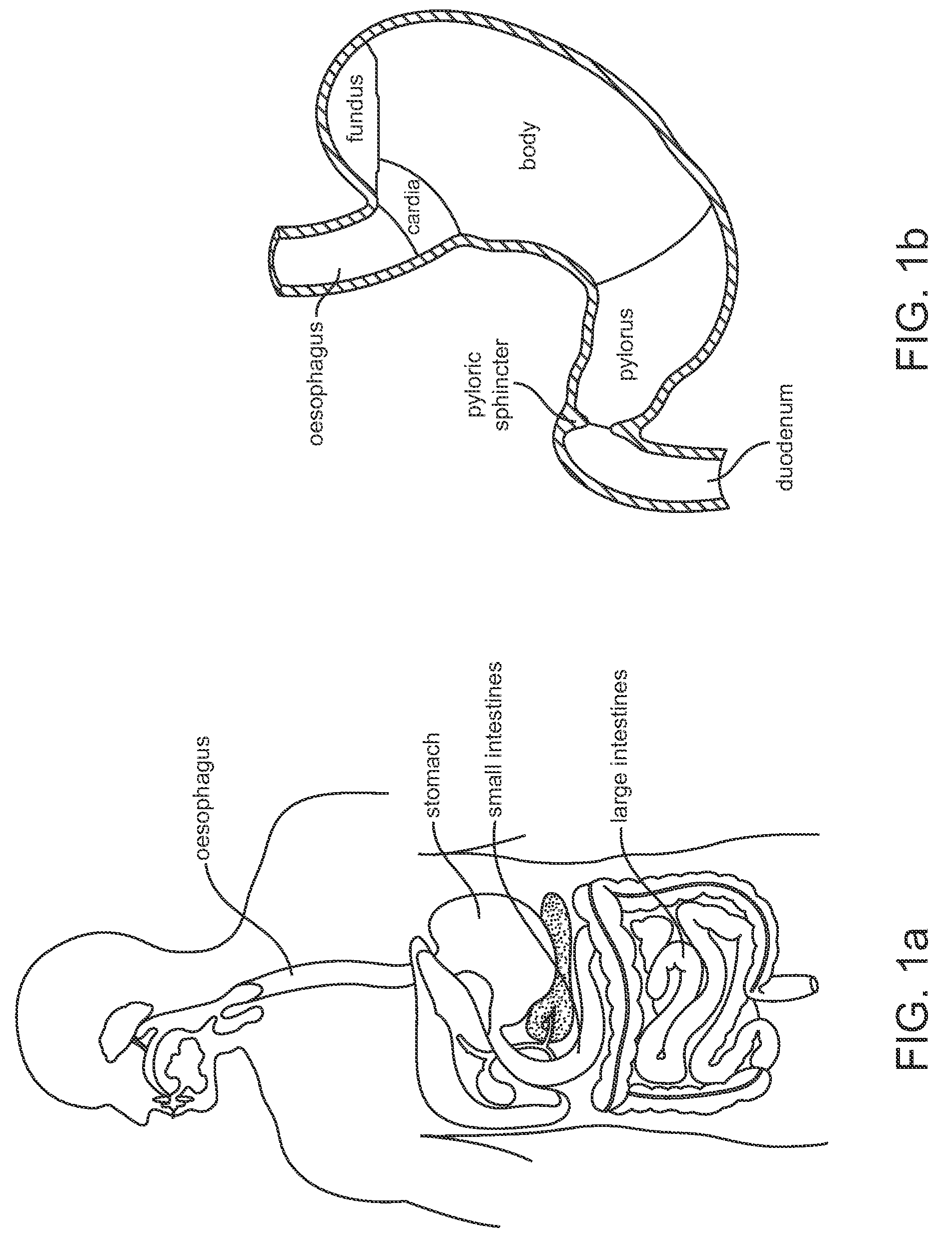 Systems and methods for implantable leadless gastrointestinal tissue stimulation