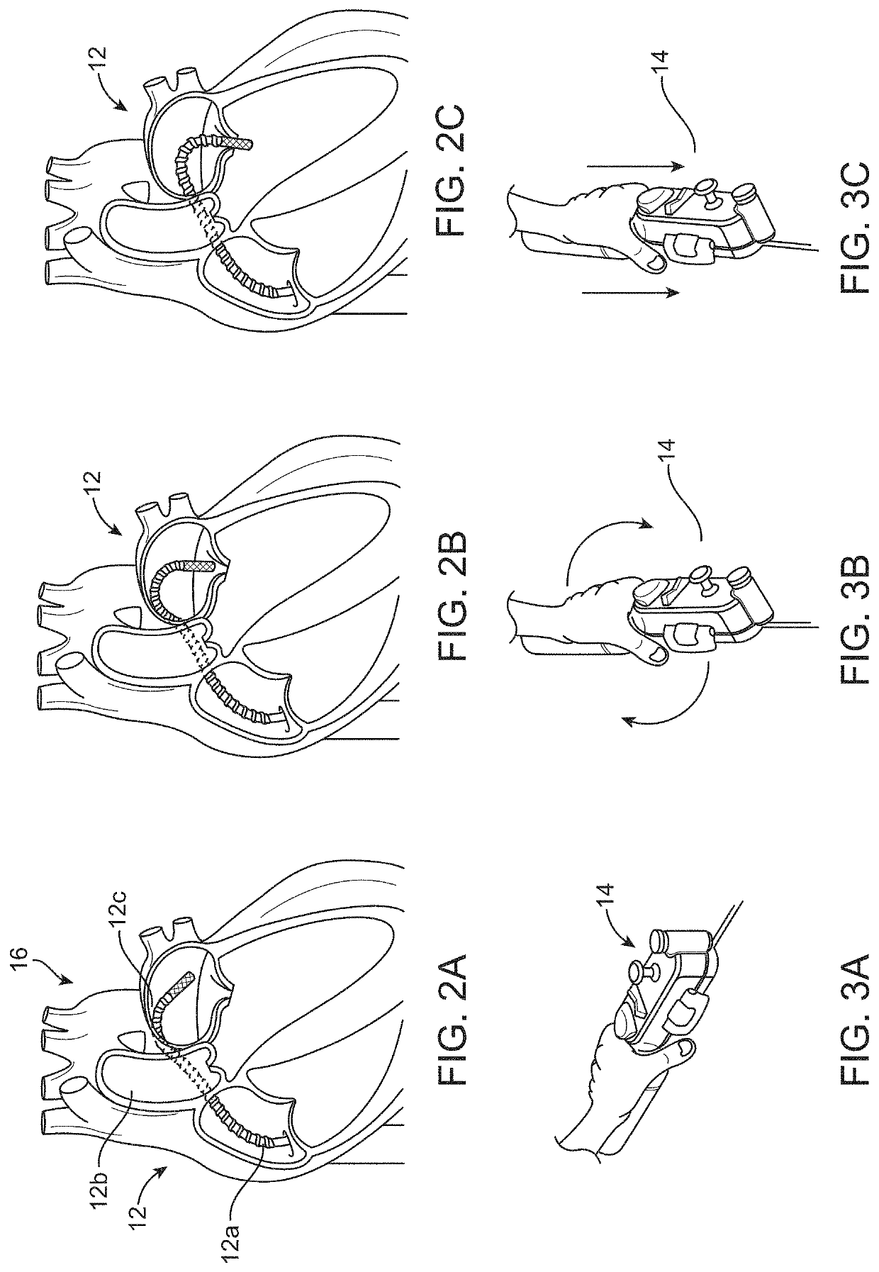 Matrix supported balloon articulation systems, devices, and methods for catheters and other uses