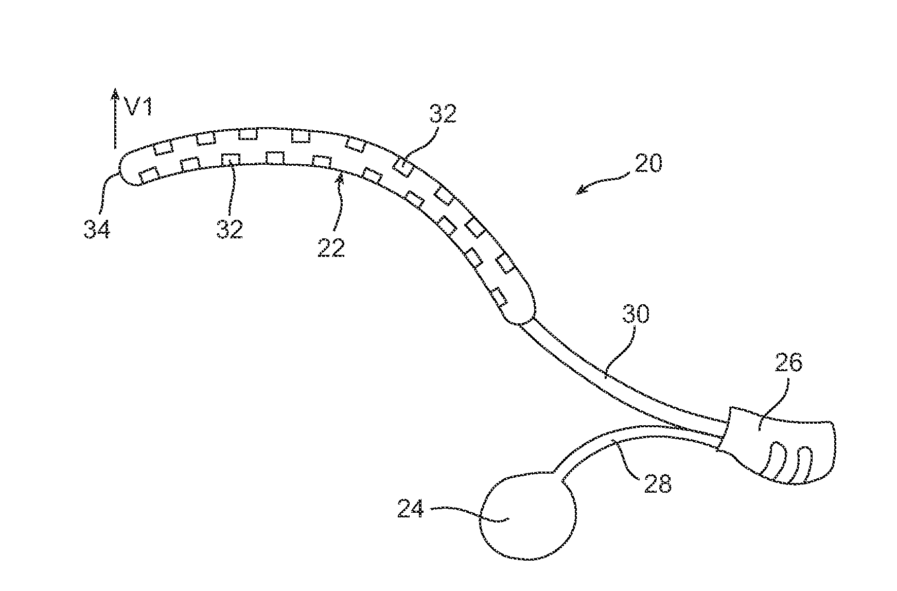 Fluid filled implants for treating medical conditions