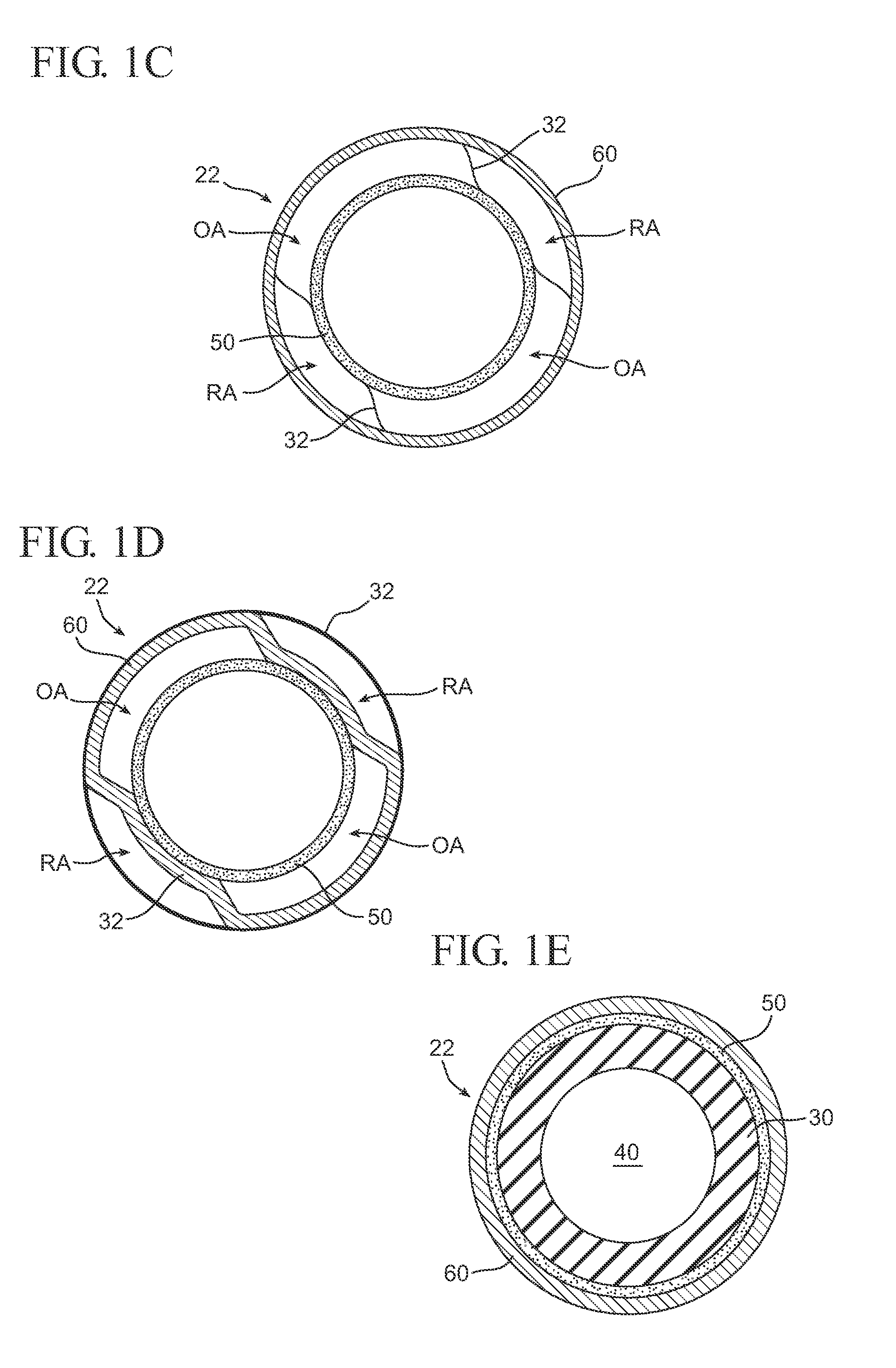 Fluid filled implants for treating medical conditions