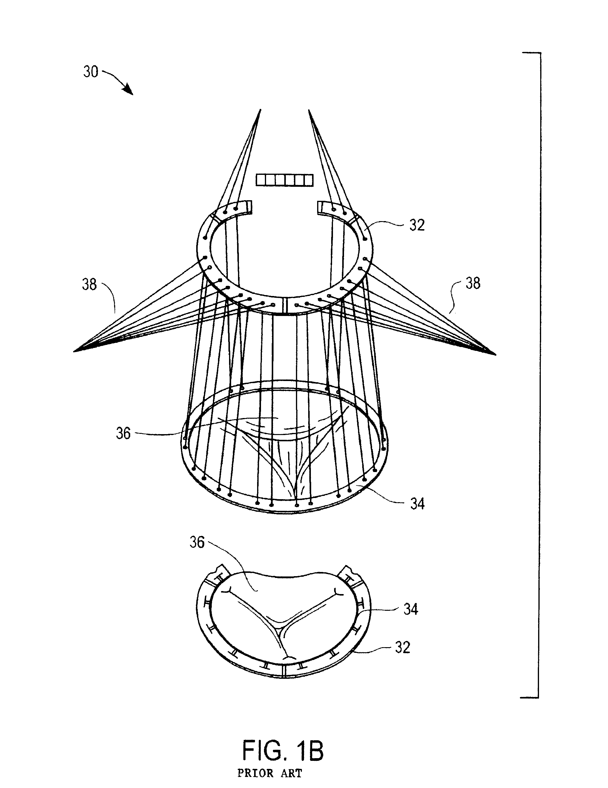 Apparatuses and methods for heart valve repair