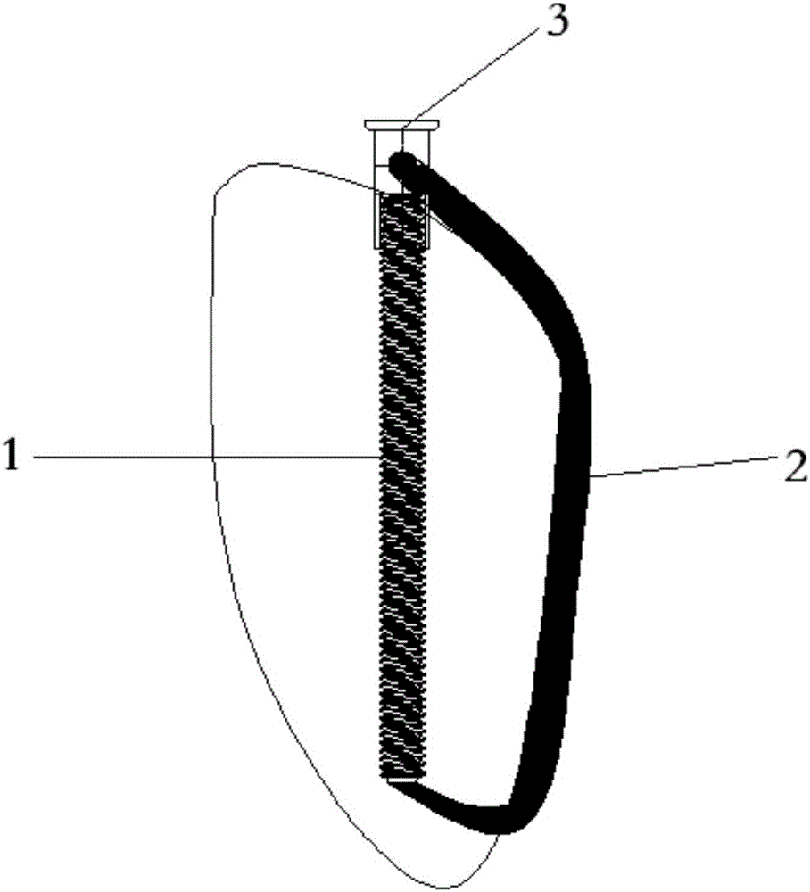 Patella locking, pressurizing and internally-fixing device