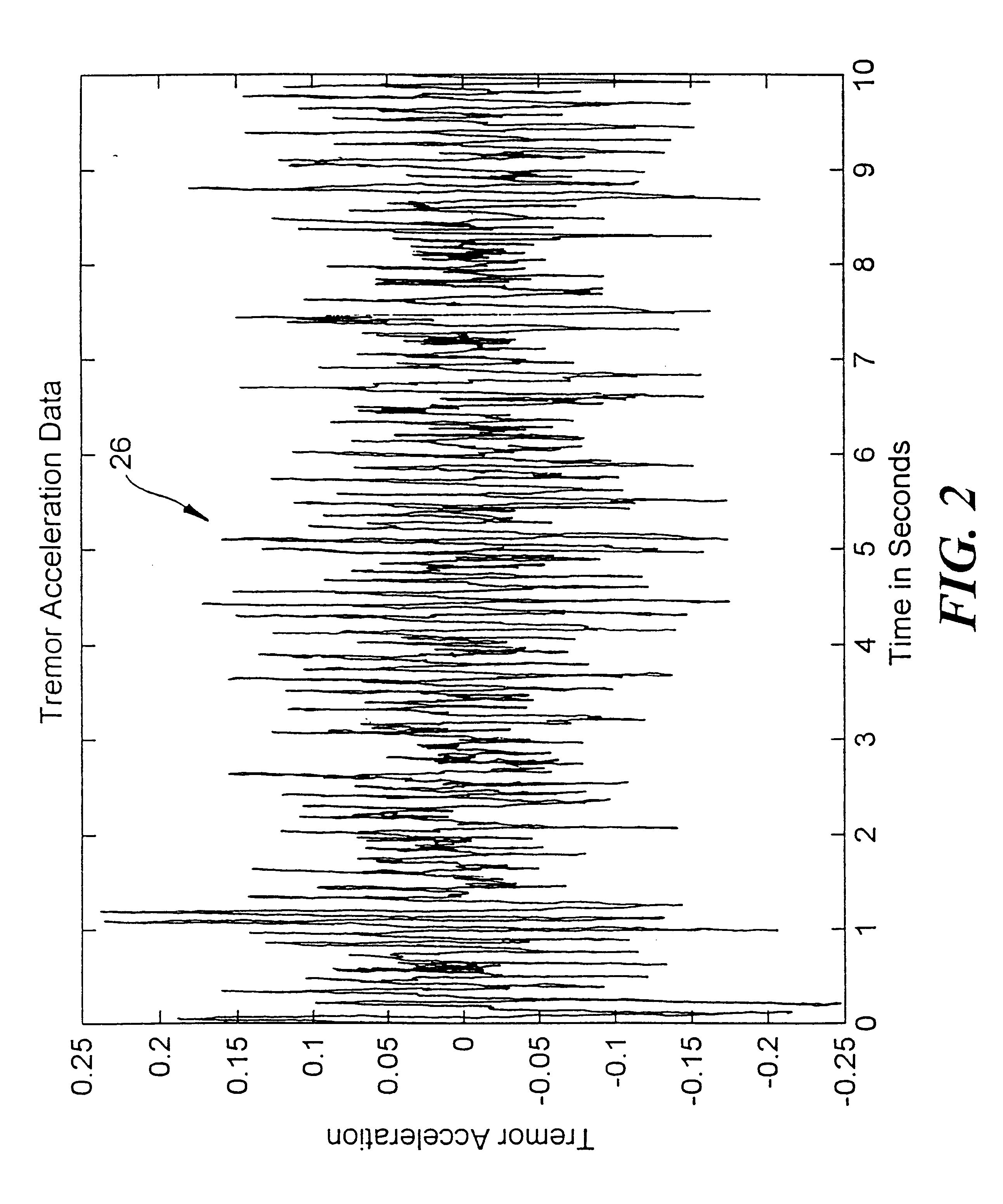 Active tremor control