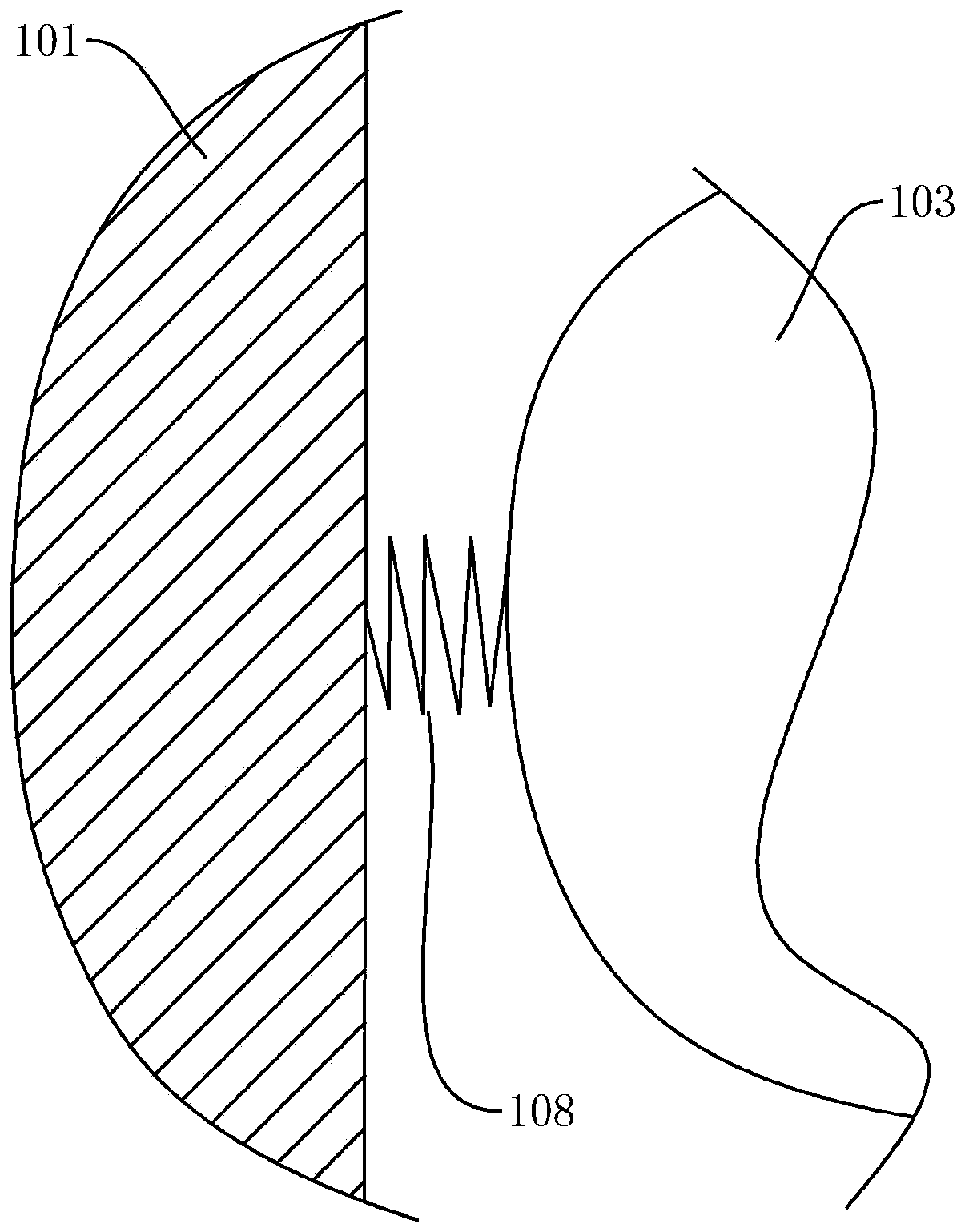 Demonstration and education system for male pelvic tumor patients