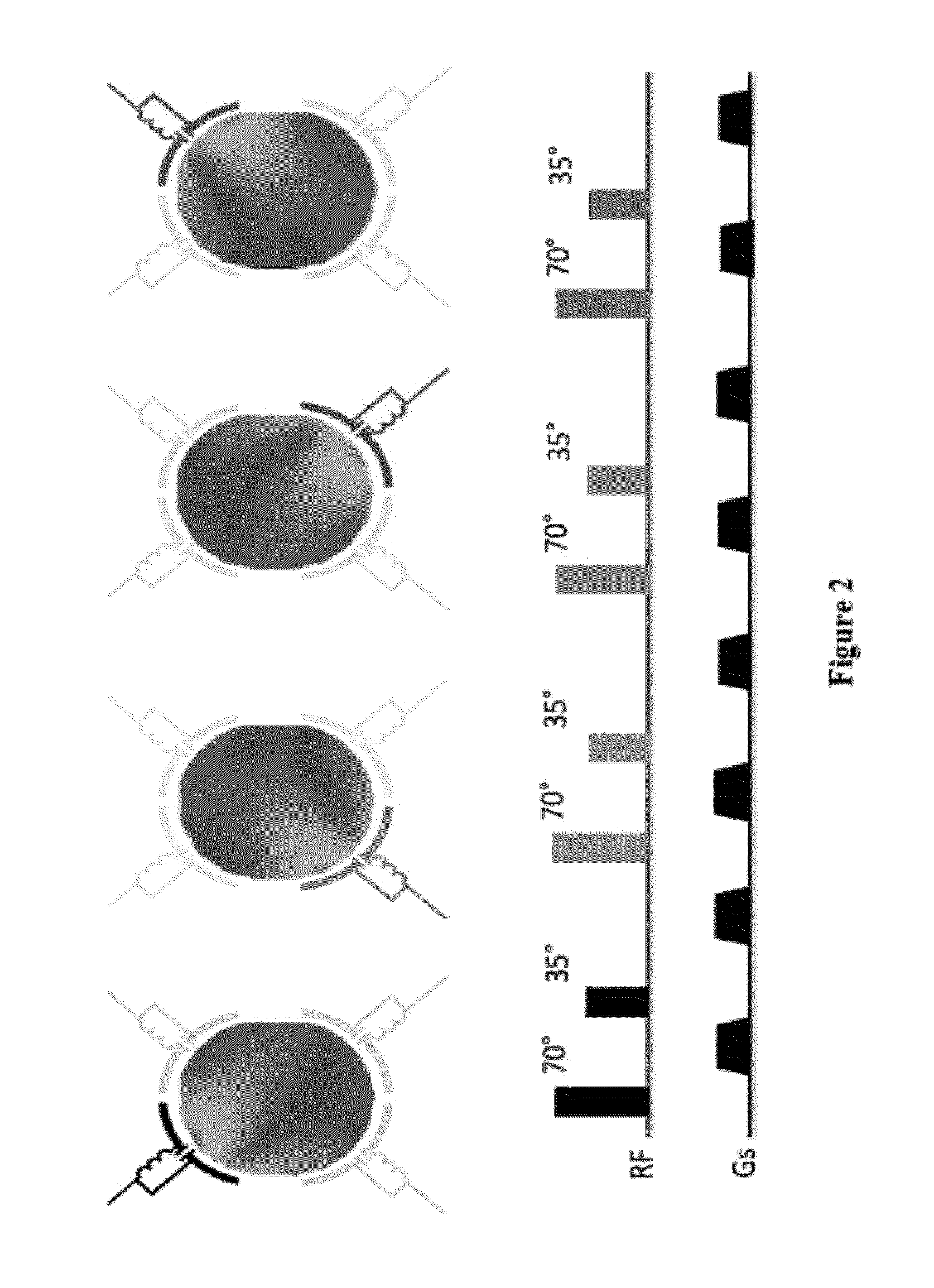 Parallel transmission by spin dynamic fingerprinting