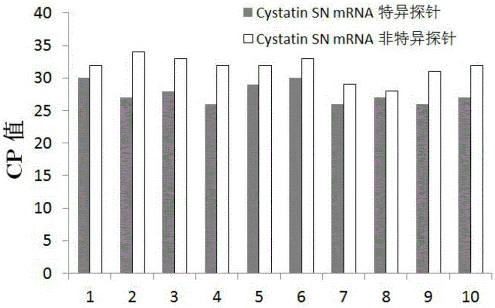 Biomarker for diagnosing and predicting breast cancer and detection kit