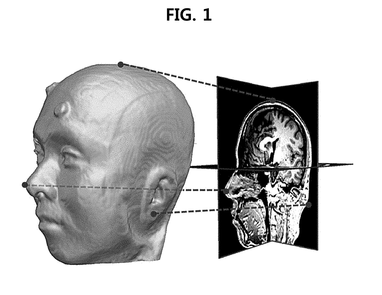 Image registration system and method using subject-specific tracker