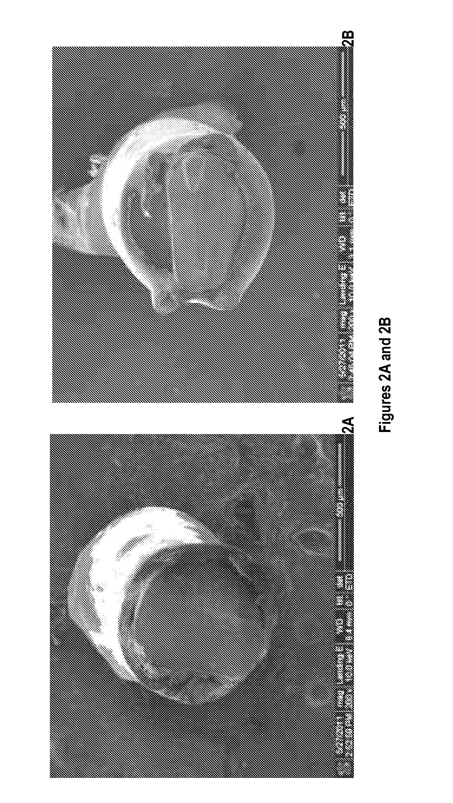 Nanoparticle-based scaffolds and implants, methods for making the same, and applications thereof