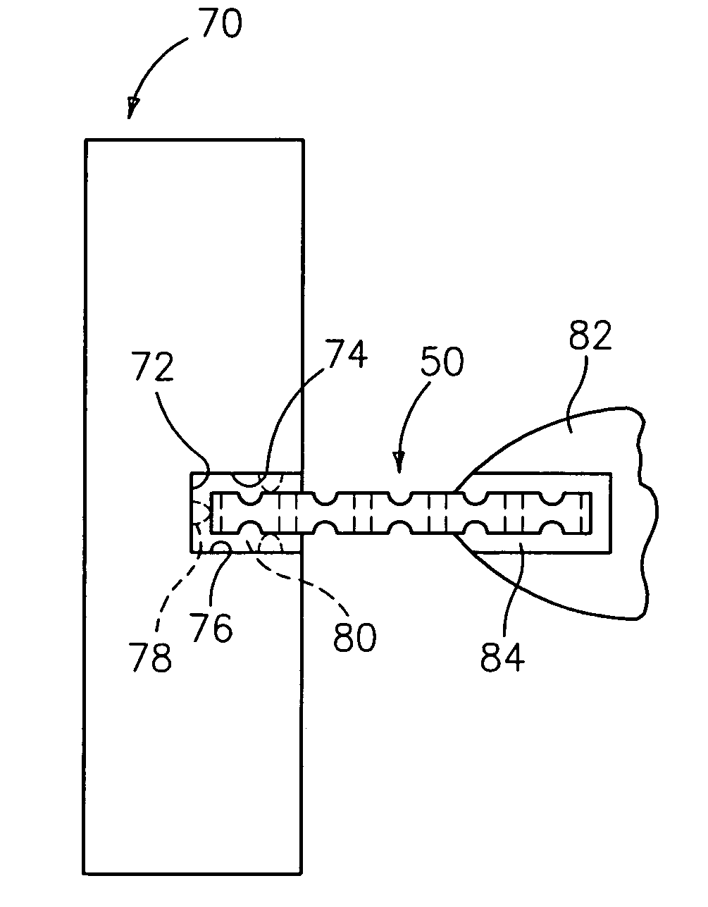 Investment casting cores and methods