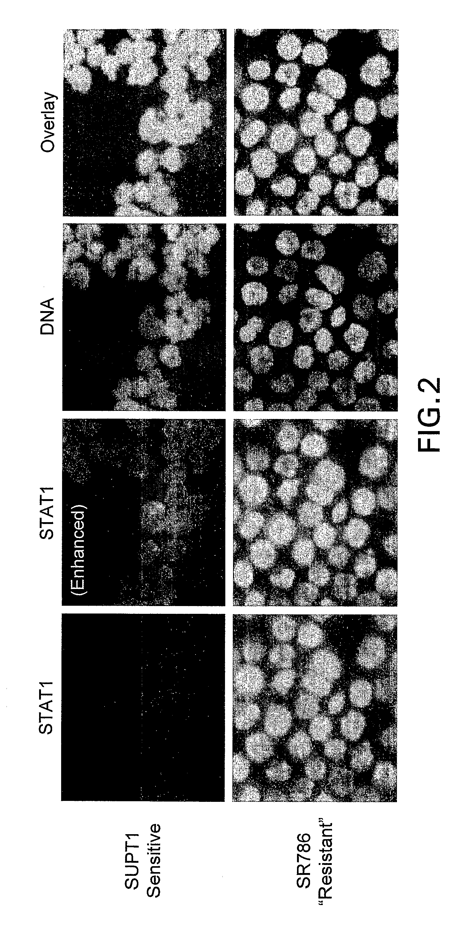 Methods for predicting treatment response based on the expression profiles of protein and transcription biomarkers