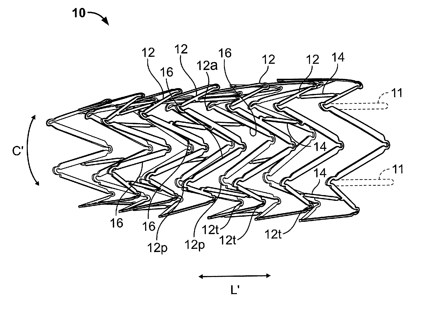 Endoluminal stent having mid-strut interconnecting members