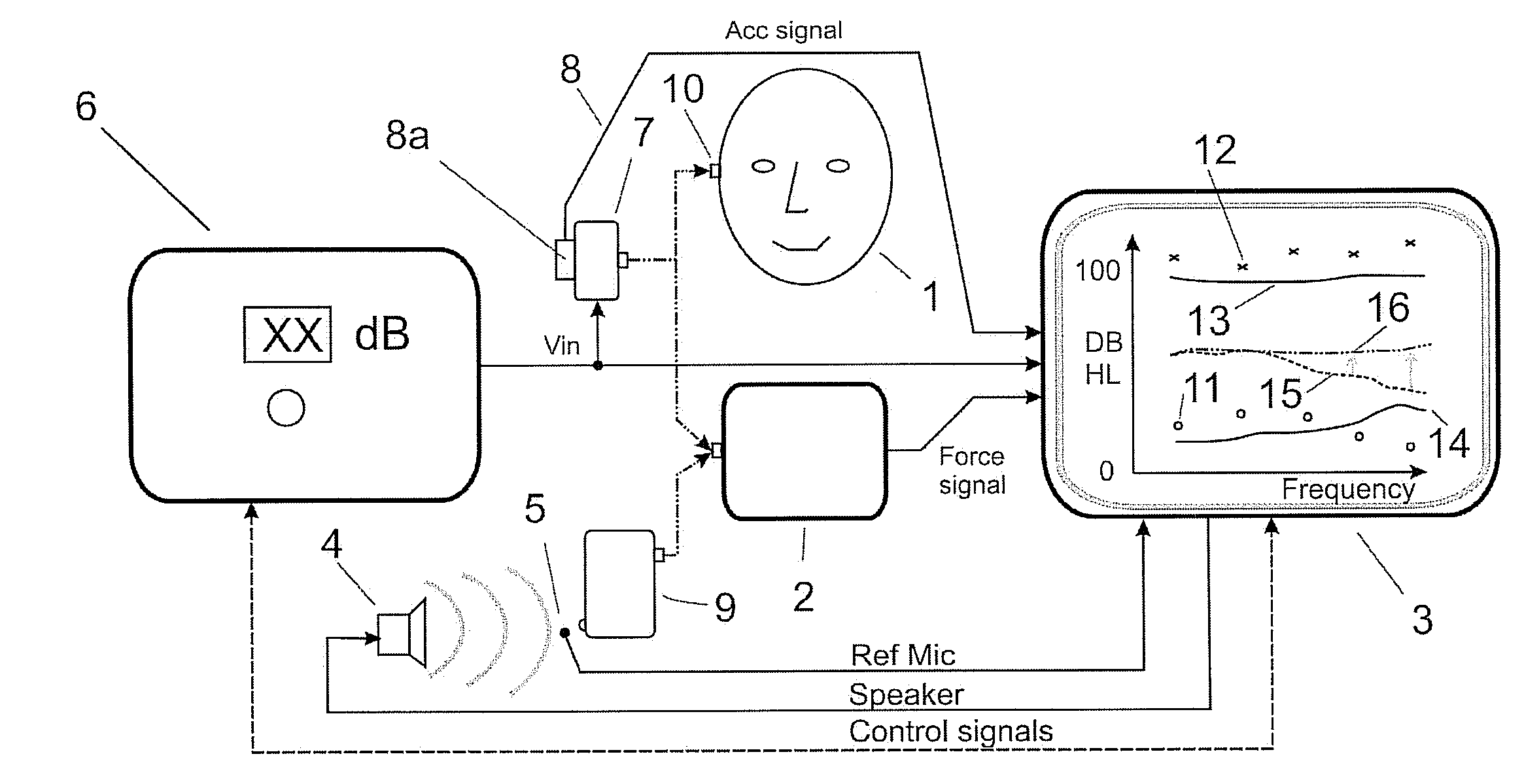 Fitting and verification procedure for direct bone conduction hearing devices