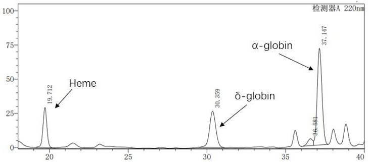 A β-globin recombinant lentiviral vector and its application