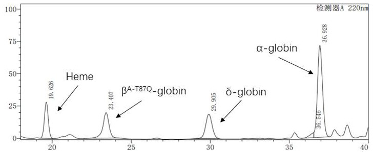 A β-globin recombinant lentiviral vector and its application