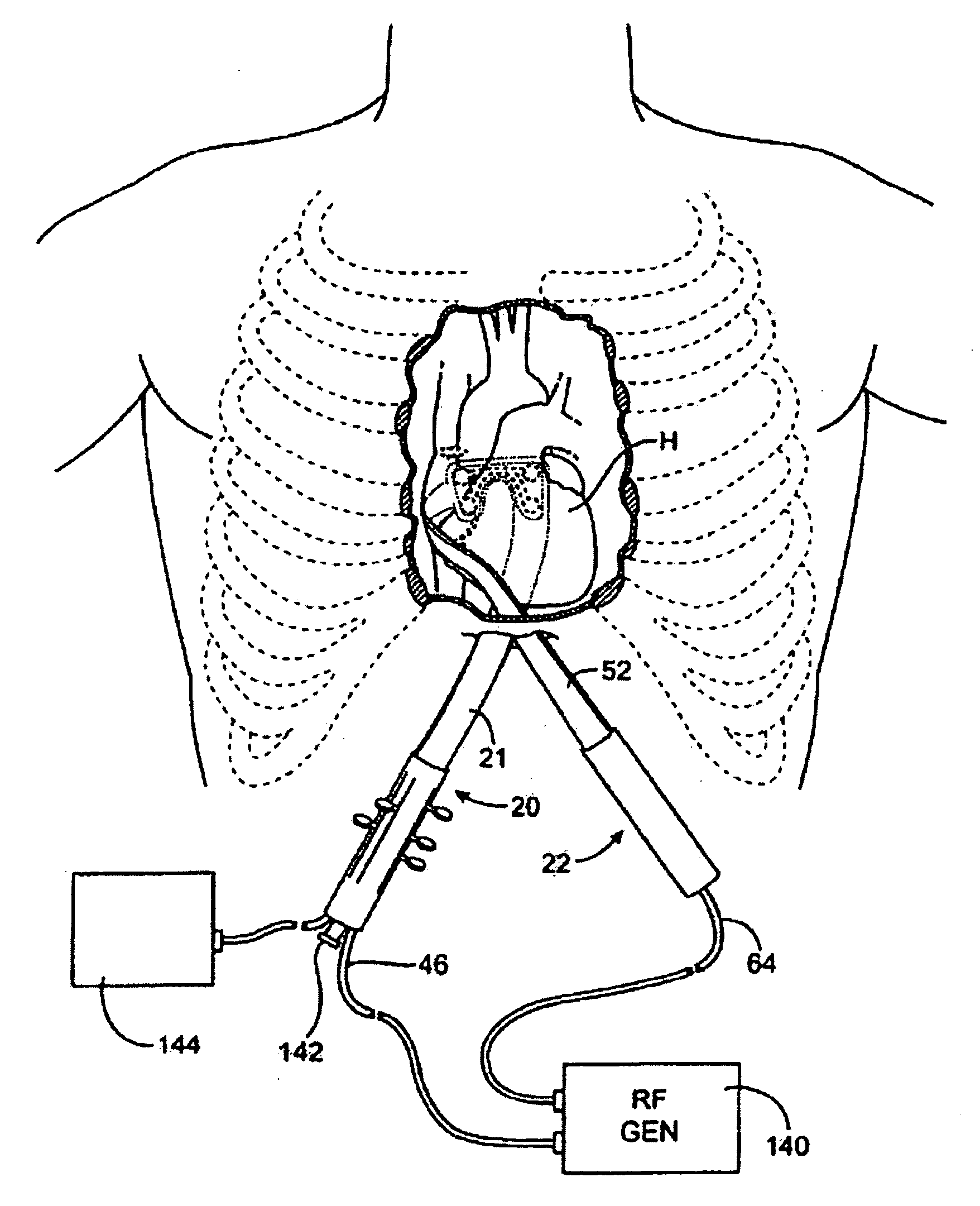 Switching methods and apparatus