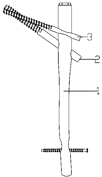 Cross-occlusion proximal femoral nail