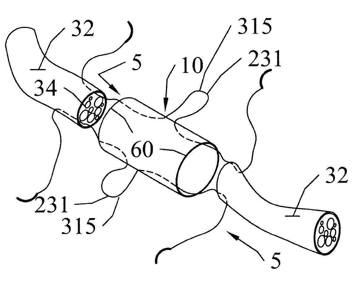 Implant devices with a pre-set pulley system