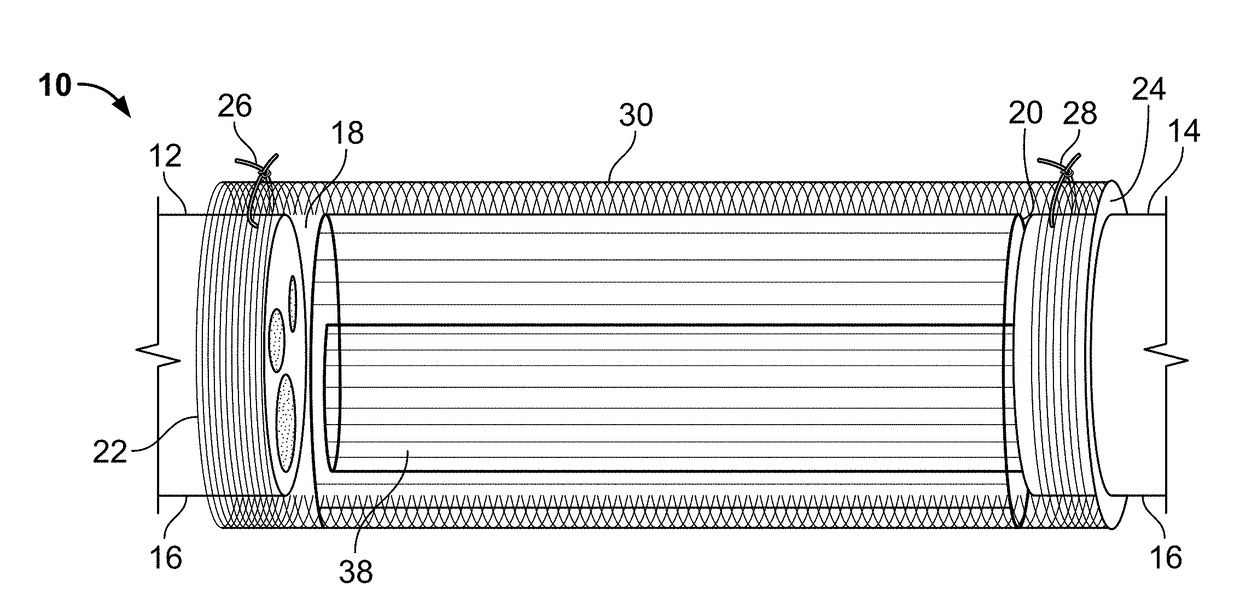 Implantable nerve guidance conduits having polymer fiber guidance channel