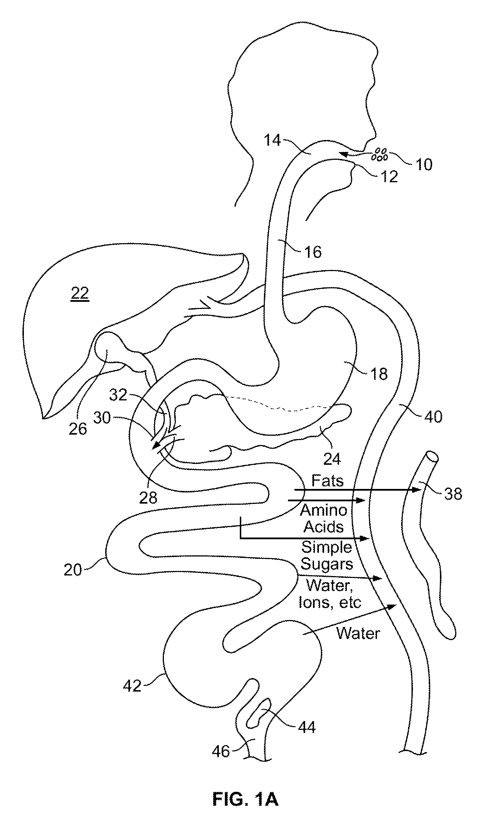 Gastrointestinal implant and methods for use