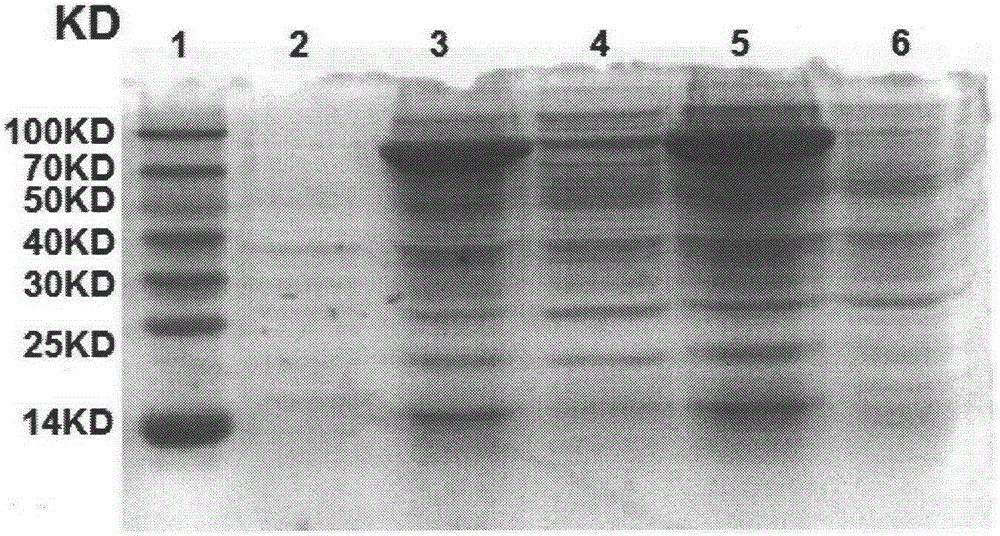 Helicobacter pylori multivalent epitope vaccine and preparation method thereof