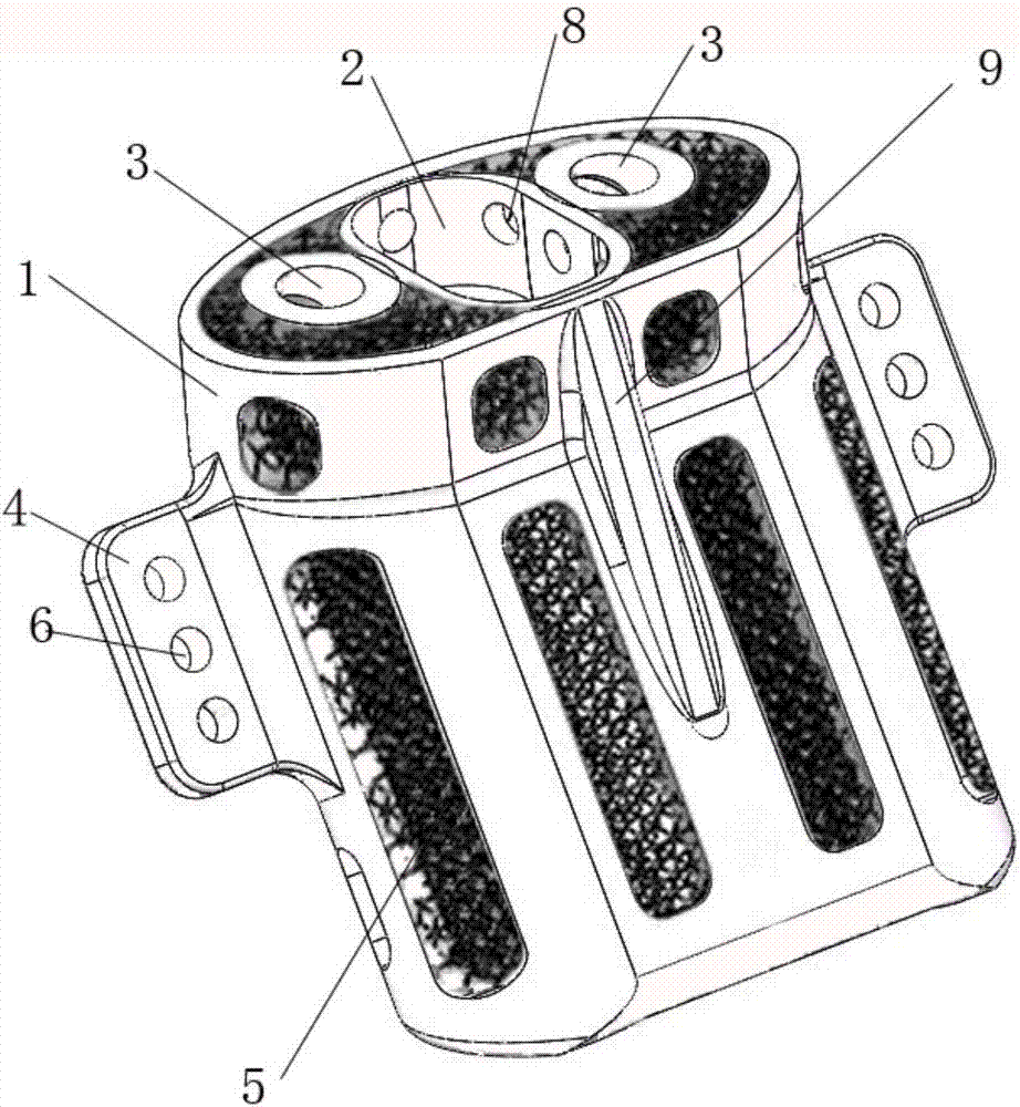 Human sacral prosthesis fusion device and preparing method thereof