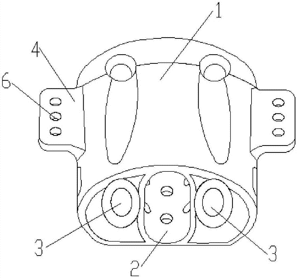 Human sacral prosthesis fusion device and preparing method thereof