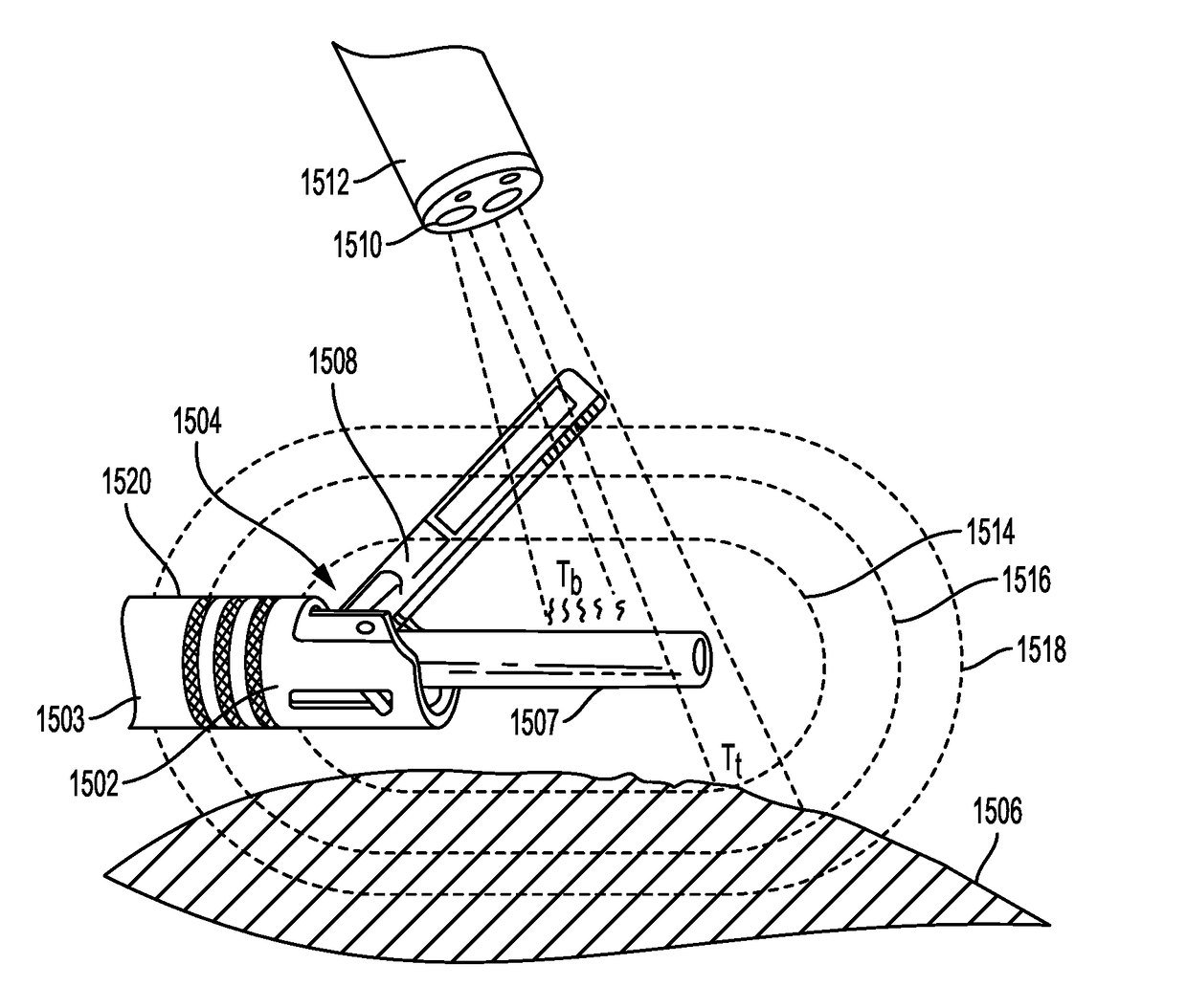 Surgical Tool Positioning Based on Sensed Parameters