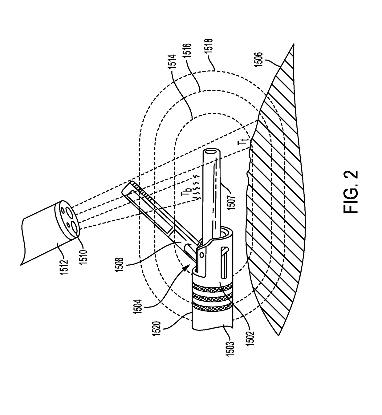 Surgical Tool Positioning Based on Sensed Parameters