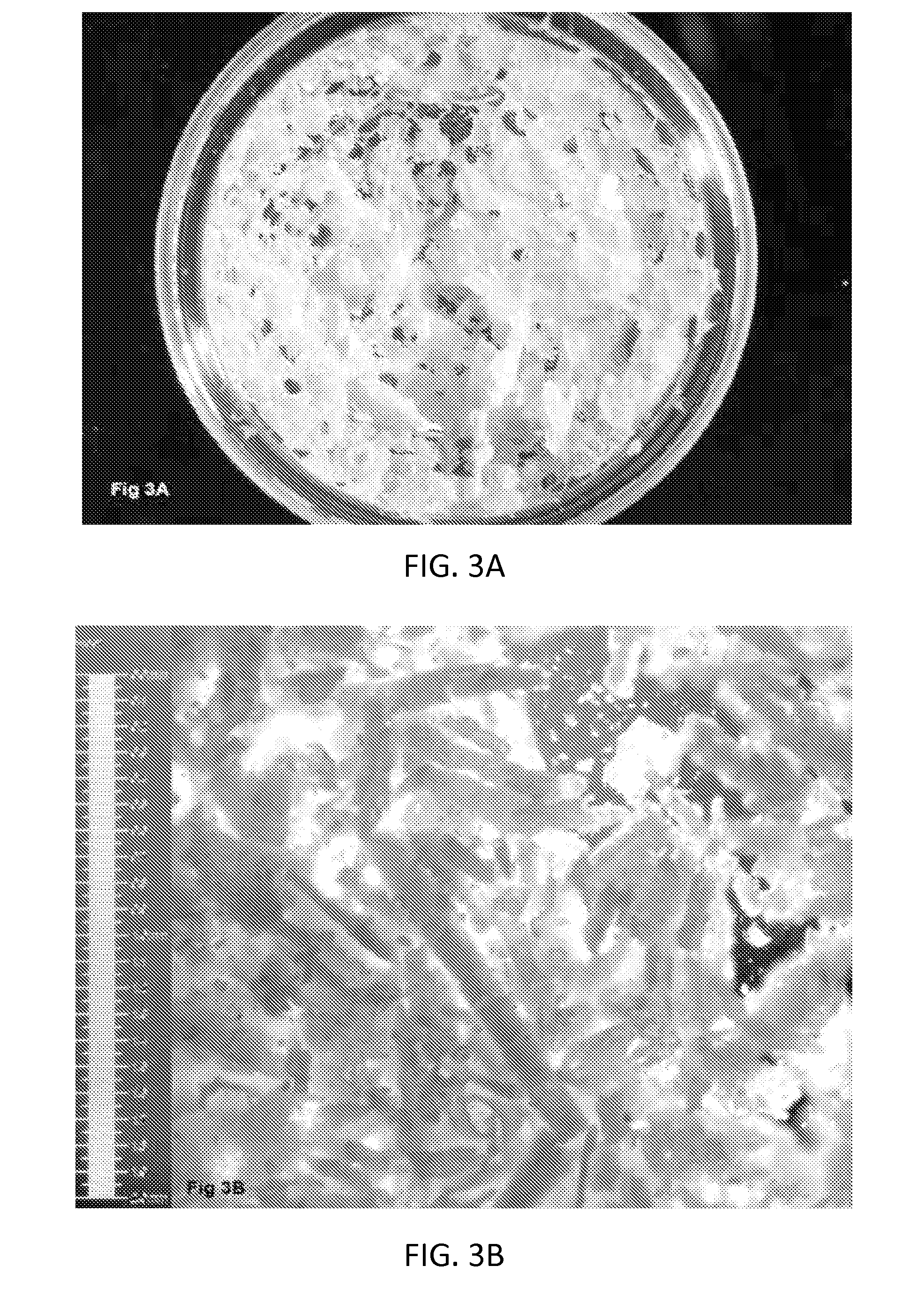 Composition and method of preparation of bone allograft from endosteal portion of bone and isolated bone periosteum