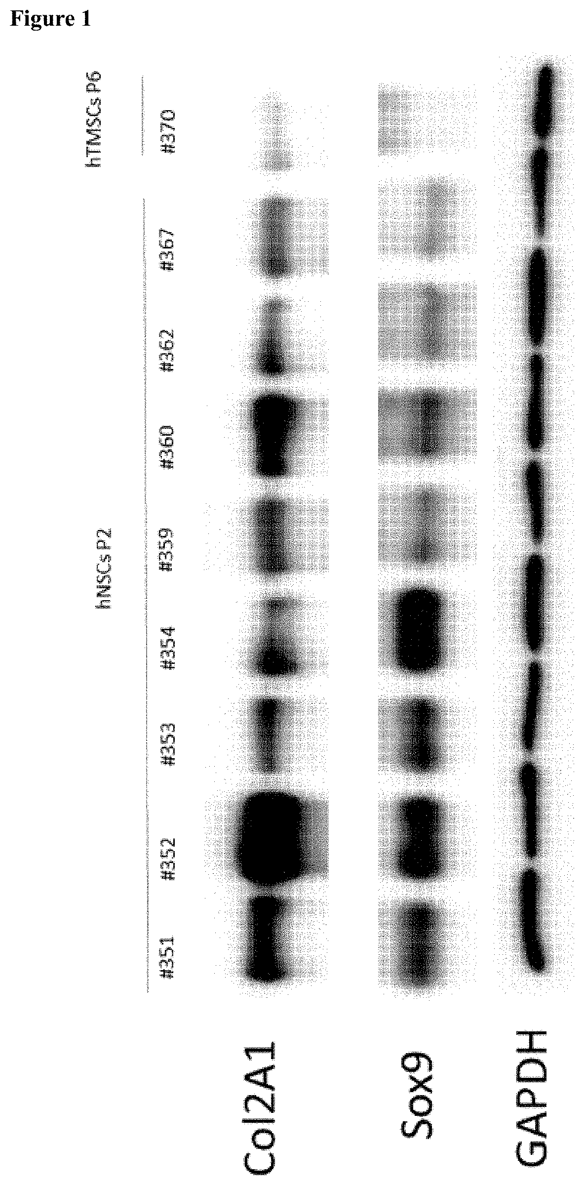 Pharmaceutical composition for treating cartilage damage, comprising nasal septum chondrocytes