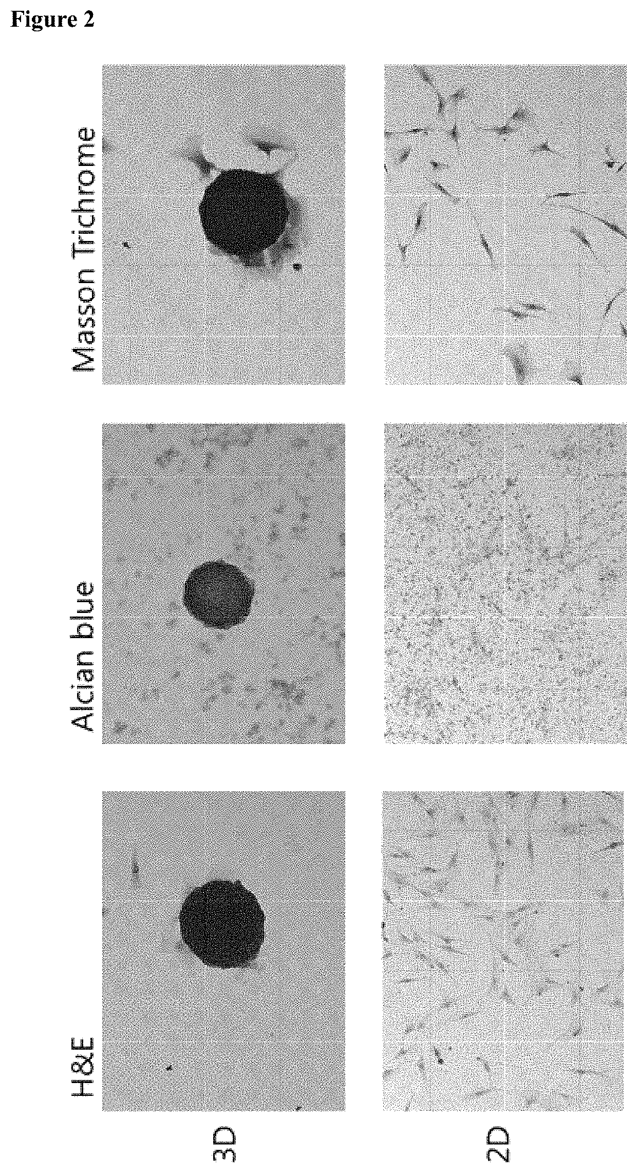 Pharmaceutical composition for treating cartilage damage, comprising nasal septum chondrocytes