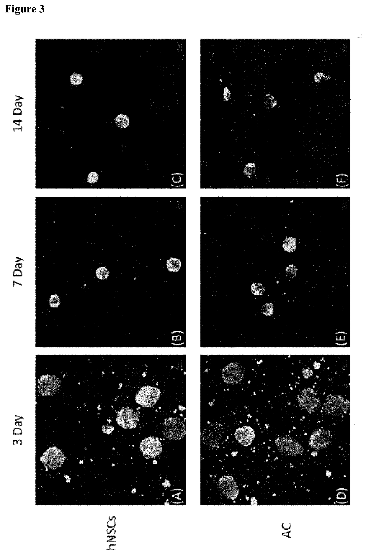 Pharmaceutical composition for treating cartilage damage, comprising nasal septum chondrocytes