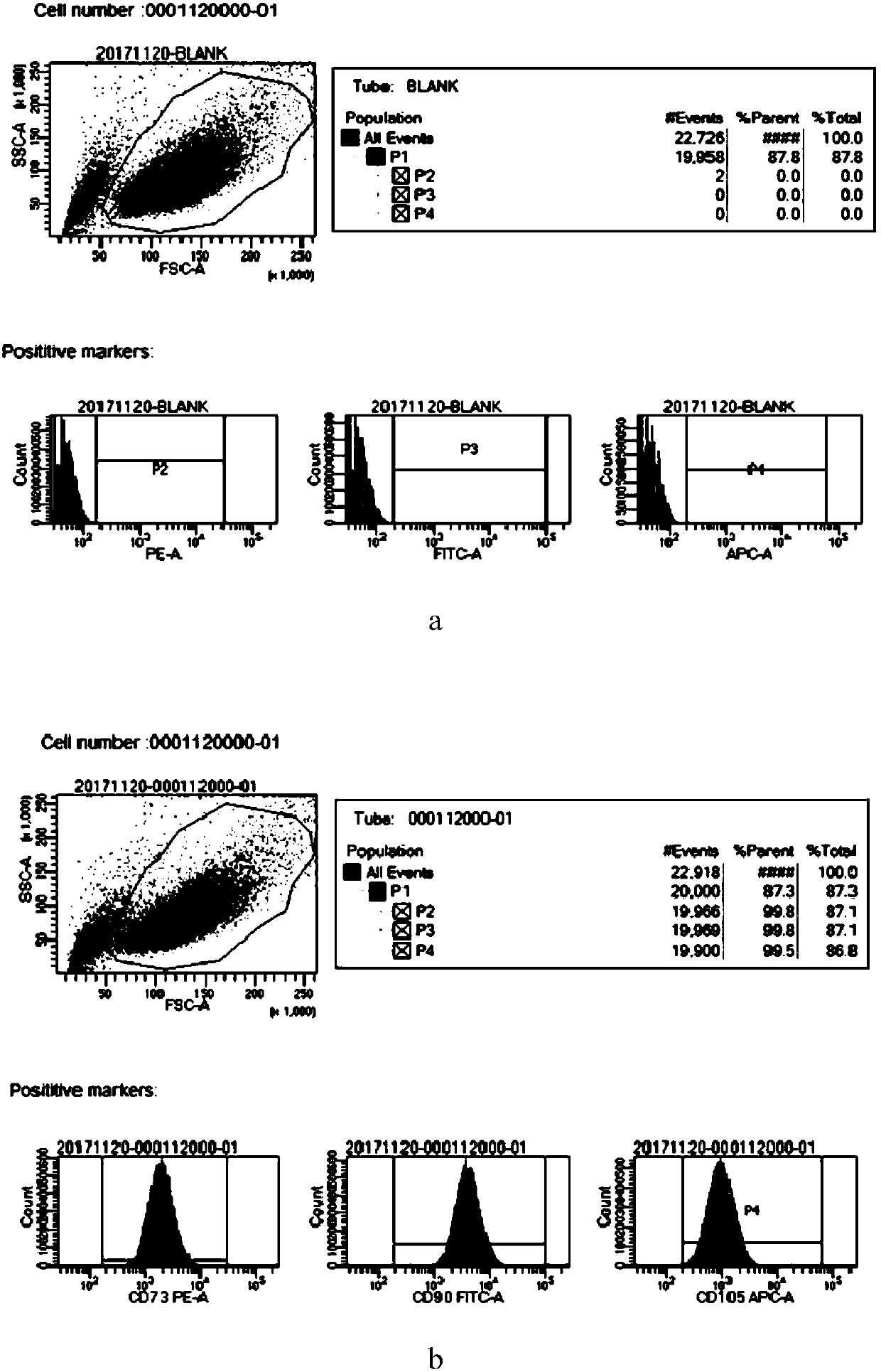 Hydro lifting instrument injection umbilical cord mesenchymal stem cell preparation and application thereof