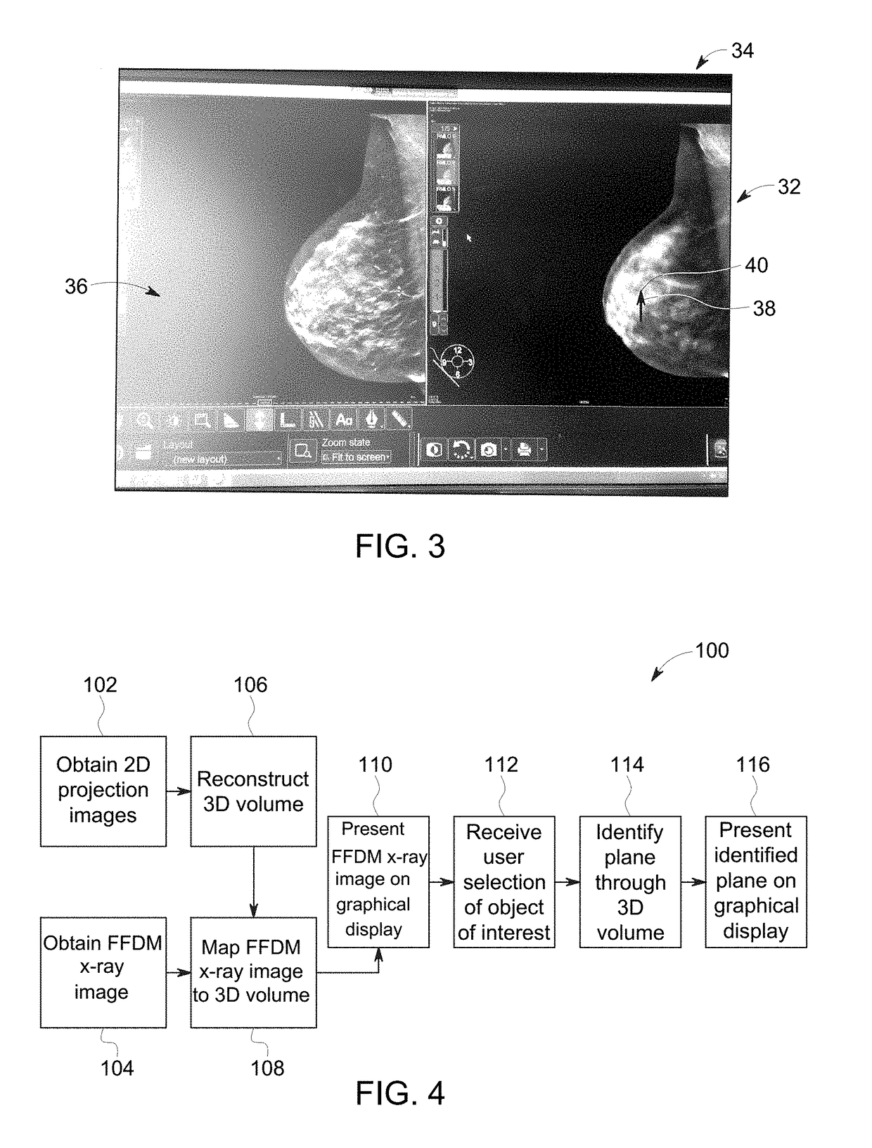 Combined medical imaging