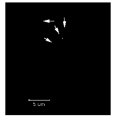 Fluorescence in situ hybridization method for positioning 45S rDNA on plant chromosome