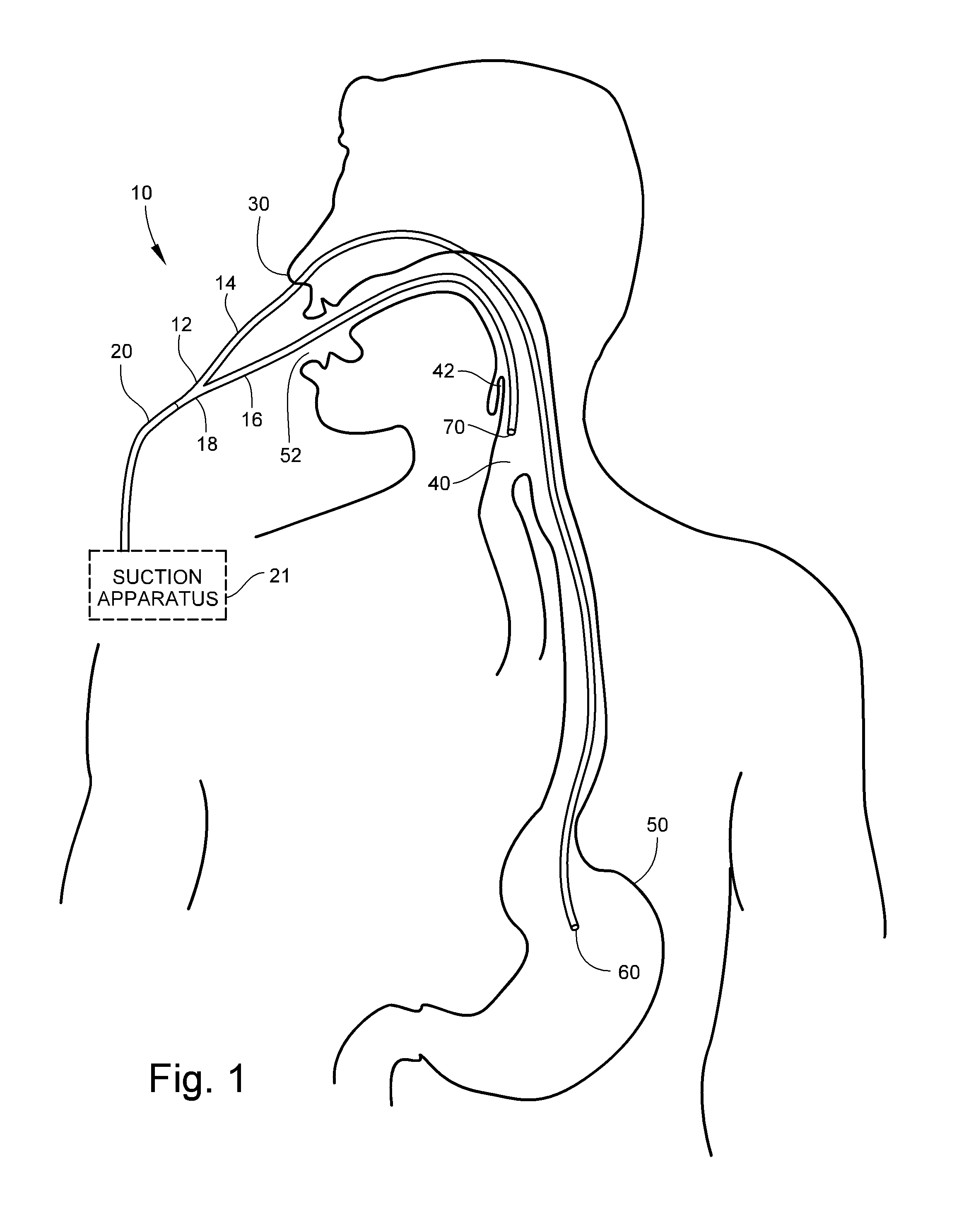 Medical Apparatus With Hypopharyngeal Suctioning Capability