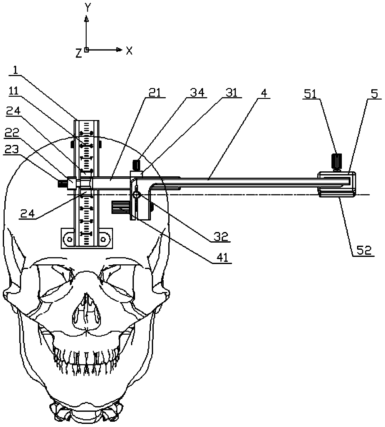 Minimally invasive locator for brain puncture