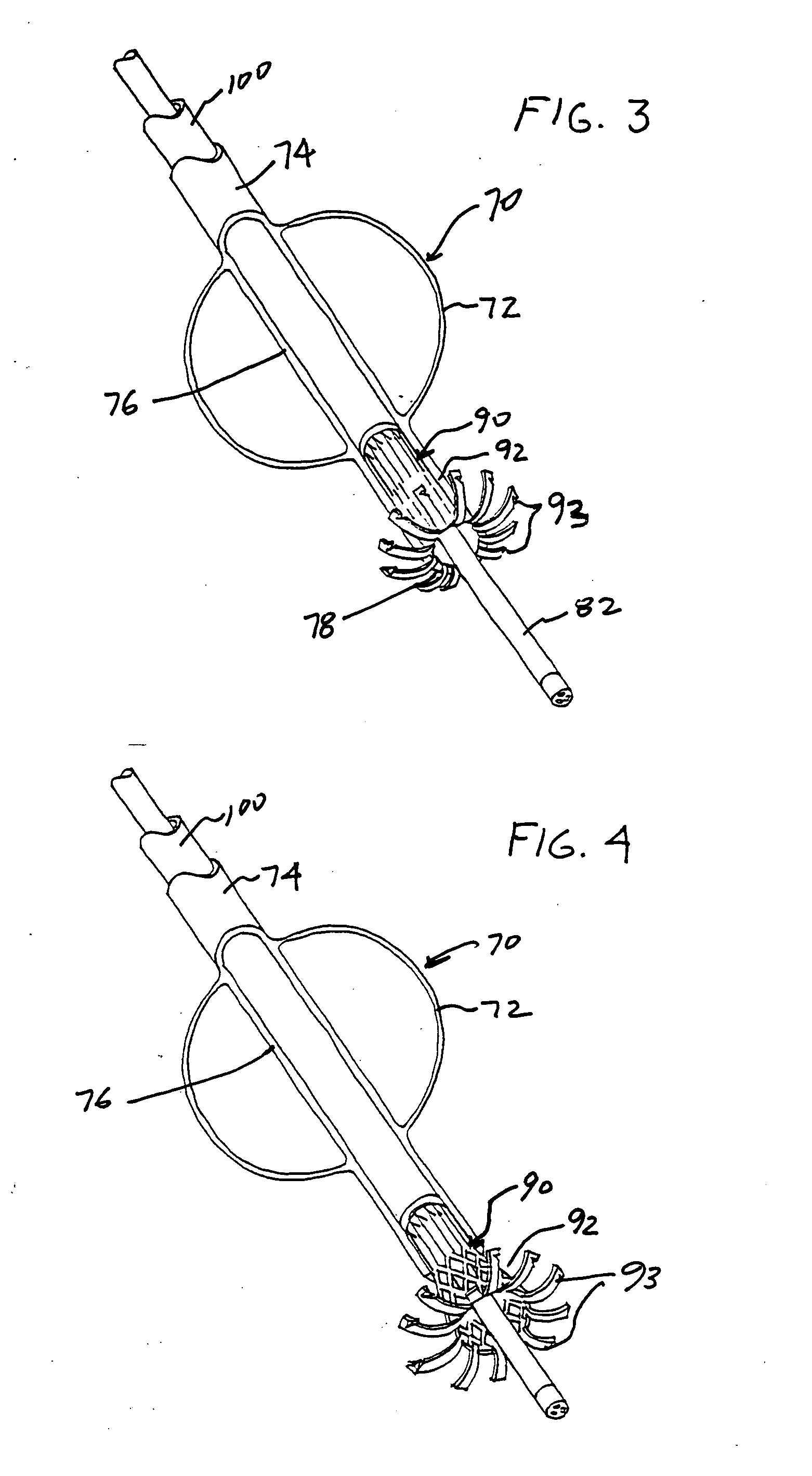 Transesophageal gastric reduction device, system and method